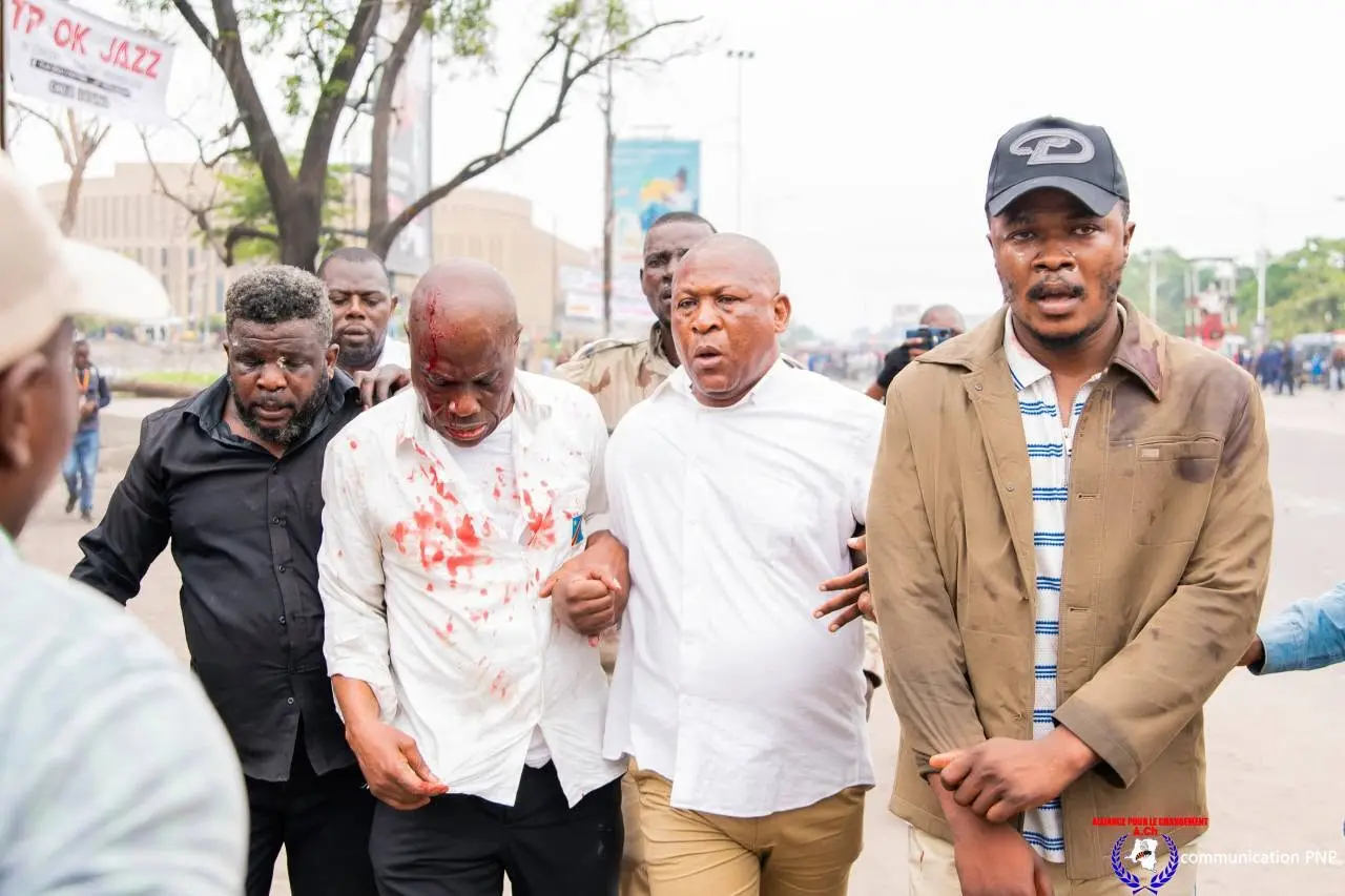 Kinshasa sous tension : le sit-in de l&rsquo;opposition dispersé, plusieurs leaders blessés